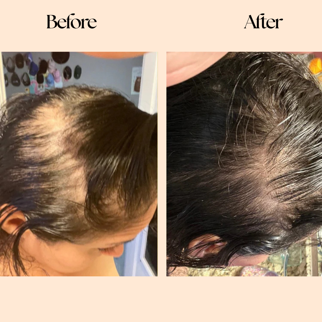 Grow Factor Hair Growth Chews