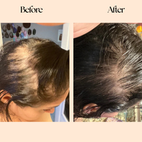 Grow Factor Hair Growth Chews