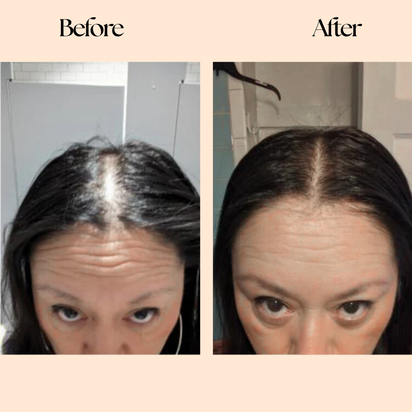 Grow Factor Hair Growth Chews