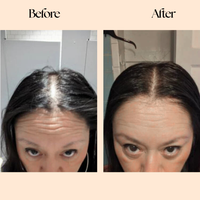 Grow Factor Hair Growth Chews