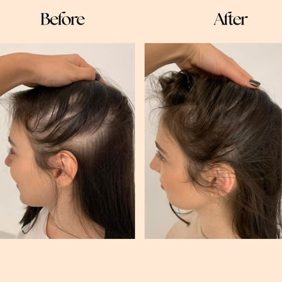 Grow Factor Hair Growth Chews